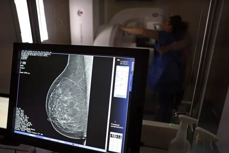 Entidades médicas pedem faixa etária maior para mamografia de rastreio 3 mamografia de rastreio 1