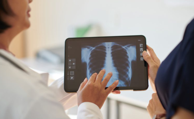 Anvisa aprova medicamento para hipertensão pulmonar
