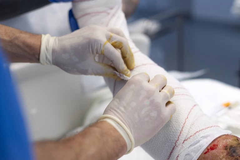 Projeto garante assistência integral e cirurgias reparadoras para vítimas de queimaduras Projeto garante assistência integral e cirurgias reparadoras para vítimas de queimaduras