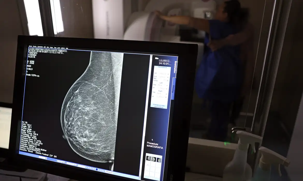 Controle do câncer da mulher negra é destaque do Outubro Rosa 2026 Controle do câncer da mulher negra é destaque do Outubro Rosa 2026