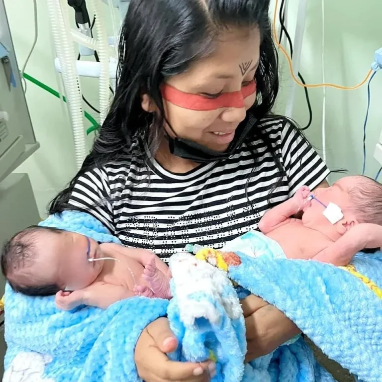 Em Parintins  Mulher Dá Entrada No Hospital E Descobre Que Estava Grávida De Gêmeos