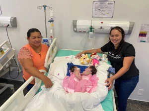 Gêmeas Siamesas Do Amazonas Recebem Alta Da Uti Após Cirurgia Complexa De Separação