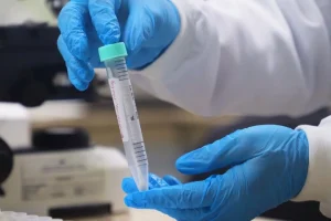 Panorama Epidemiológico da Mpox é atualizado no Amazonas, nesta quarta-feira